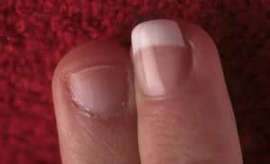 This nail biter's finger is transformed. The shape of the finished nail  draws attention away from the puffiness, and the length, which goes just  to the tip of the finger, is ideal. Any longer than this would probably  result in service breakdown
