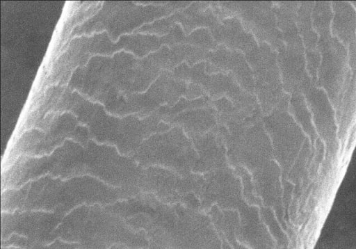 A photo of a hair follicle