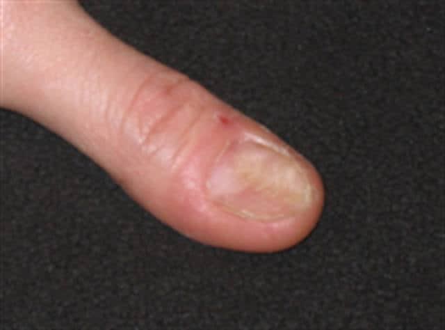 Here’s the Scoop (Scoop Nails, That Is)