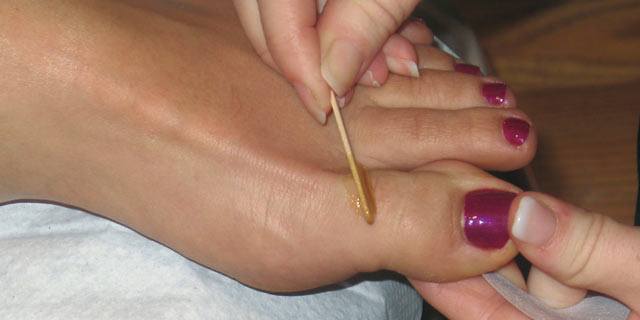 The Waxing of the Toe
