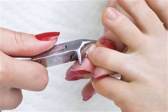 Ingrown Toenail Myths Debunked