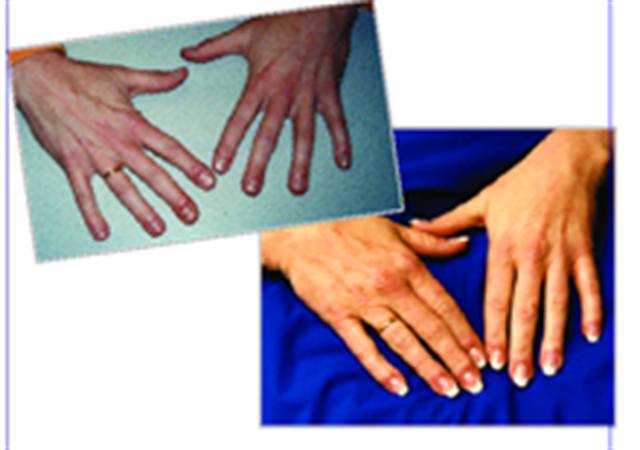 You Can Reform a Nail Biter