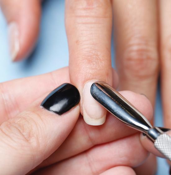 10 Common Causes of Nail Service Breakdown