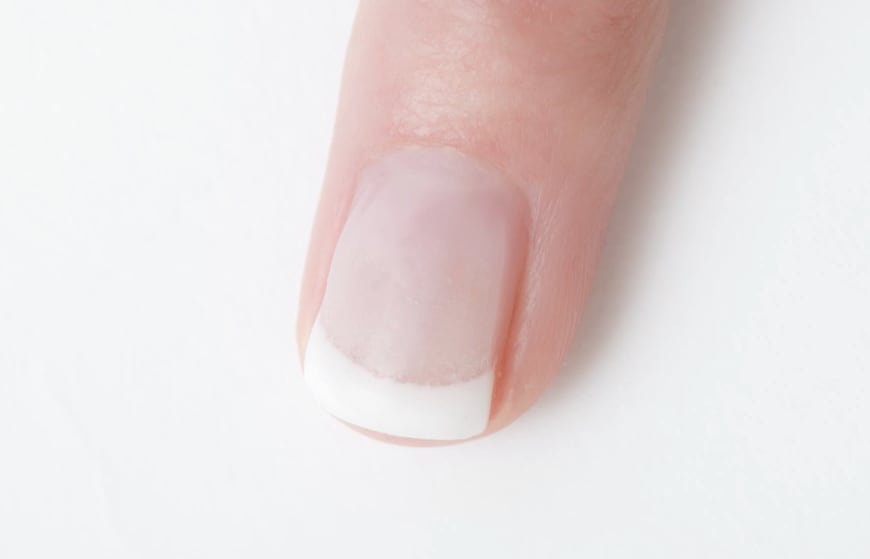 Troubleshooter: A 15-Minute Gel Fill