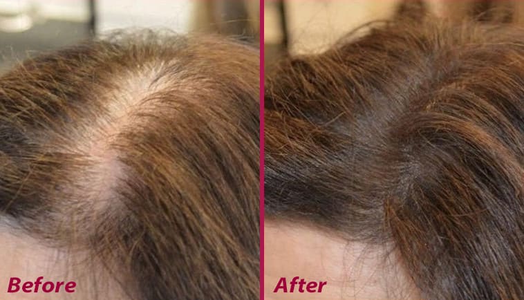 6 Truths for Stylists From a Hair Loss Expert