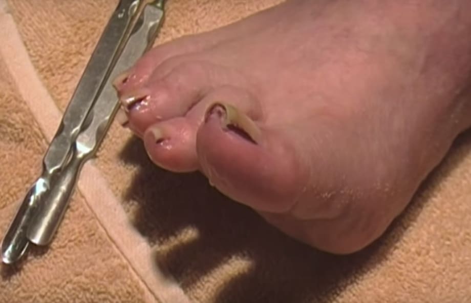 Pedicure with Buildup Tutorial on an Elderly Woman
