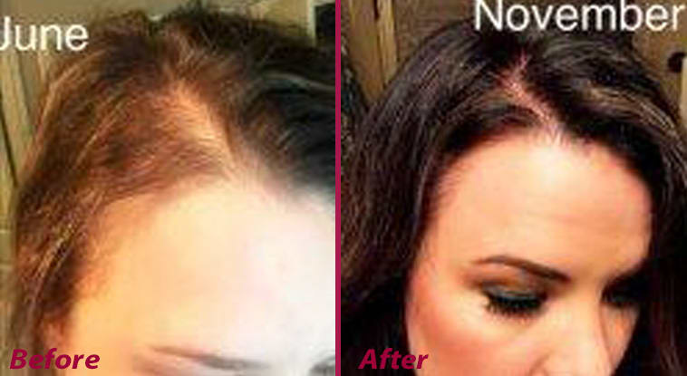 6 Truths for Stylists From a Hair Loss Expert