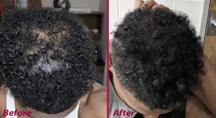 6 Truths for Stylists From a Hair Loss Expert