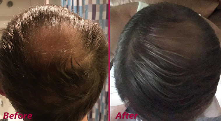 6 Truths for Stylists From a Hair Loss Expert