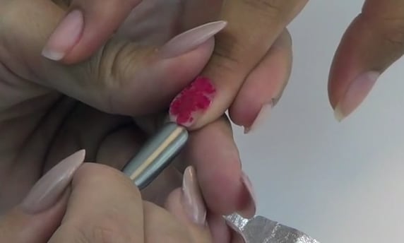 Akzentz Options Basic Removal
