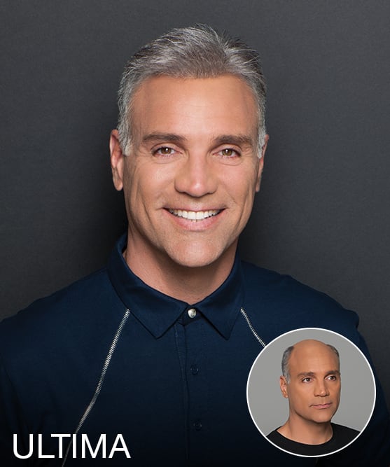 American Hairlines: Providing Hair-Replacement Solutions
