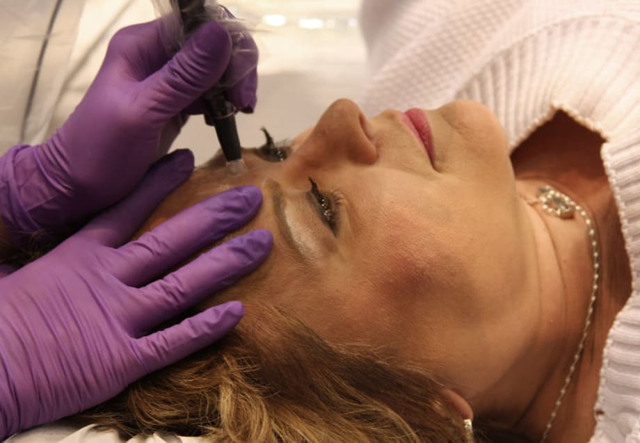 The Anti-Vampire Facelift