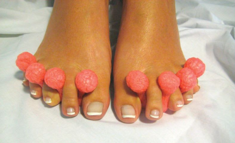 Biodegradable Toe Separators