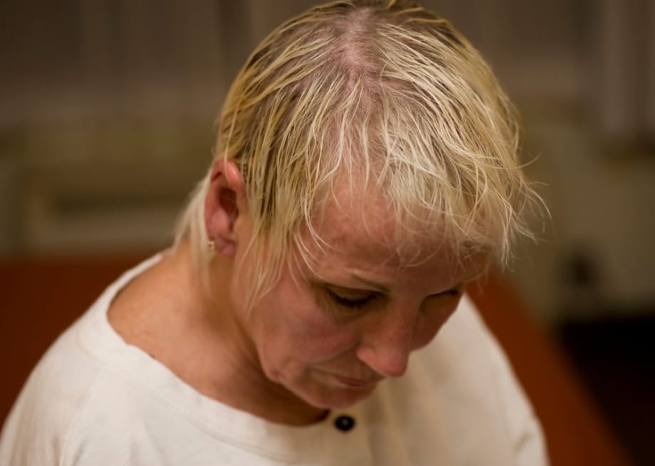 A New Hair Thinning Treatment Option