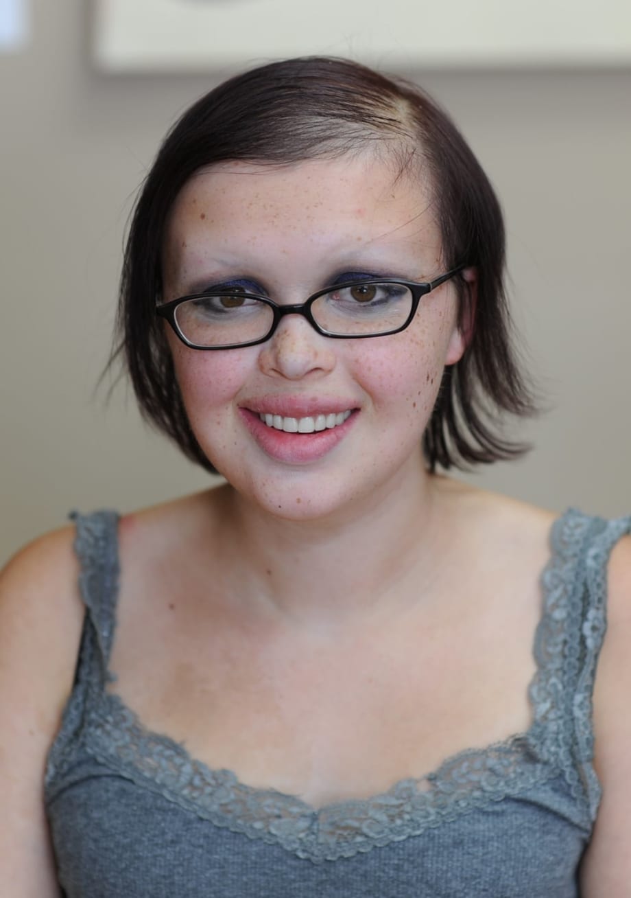 A New Hair Thinning Treatment Option