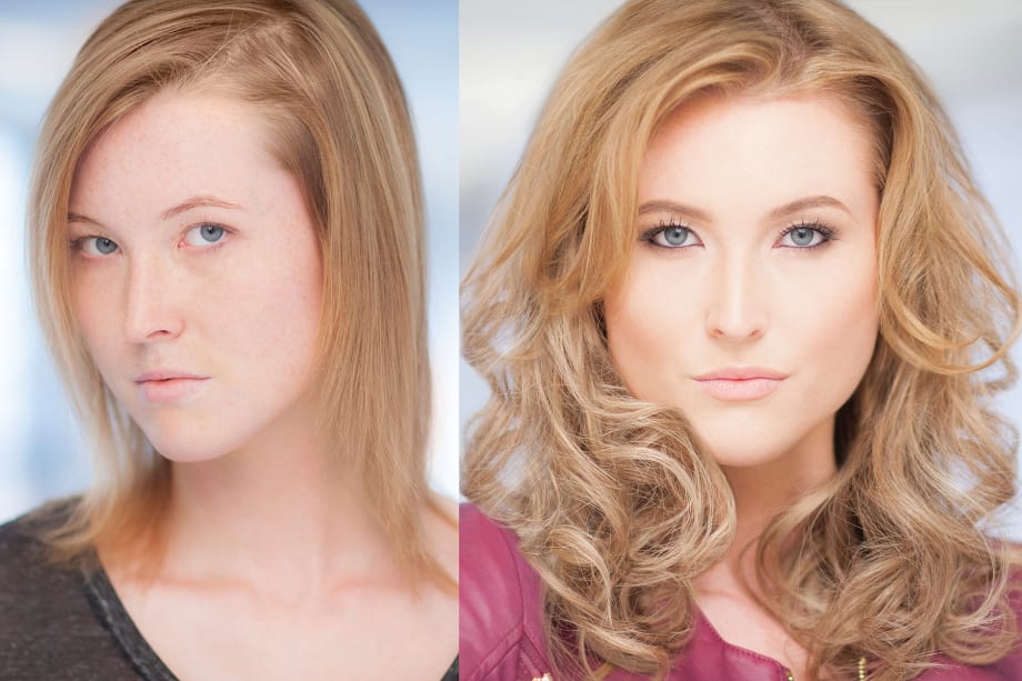 Filling the Void: A Solution to Hair Loss and Thinning