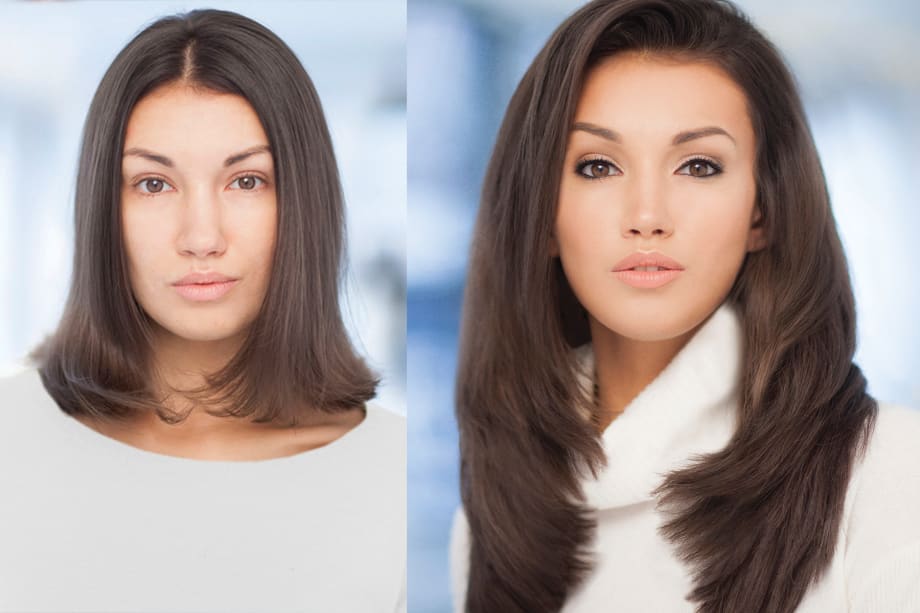 Filling the Void: A Solution to Hair Loss and Thinning