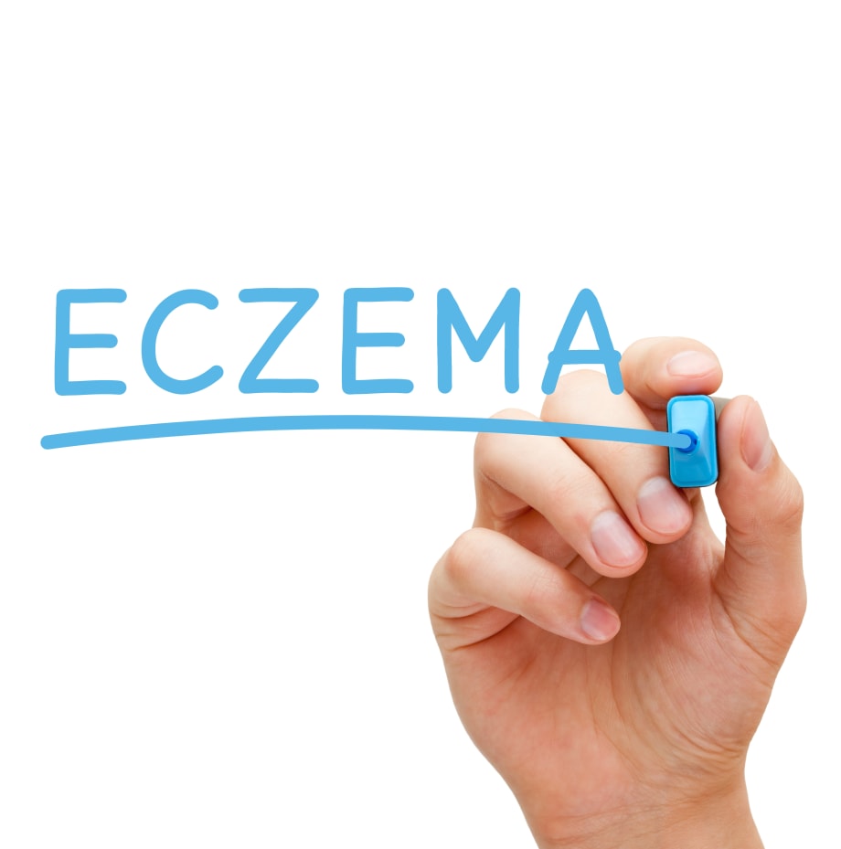 Malibu C's Focus on Eczema Awareness Month 