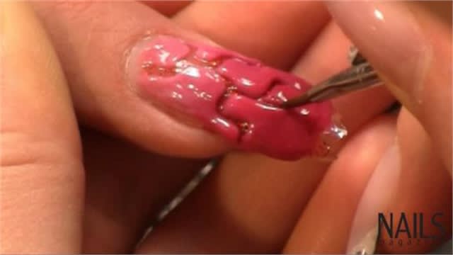 Gel Impressions Technique