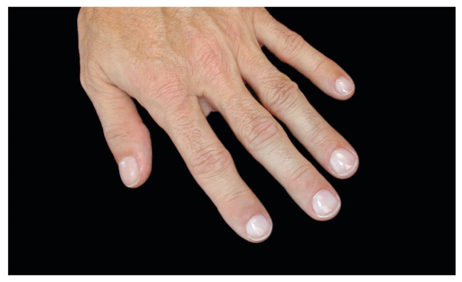Backscratcher’s Male Manicure