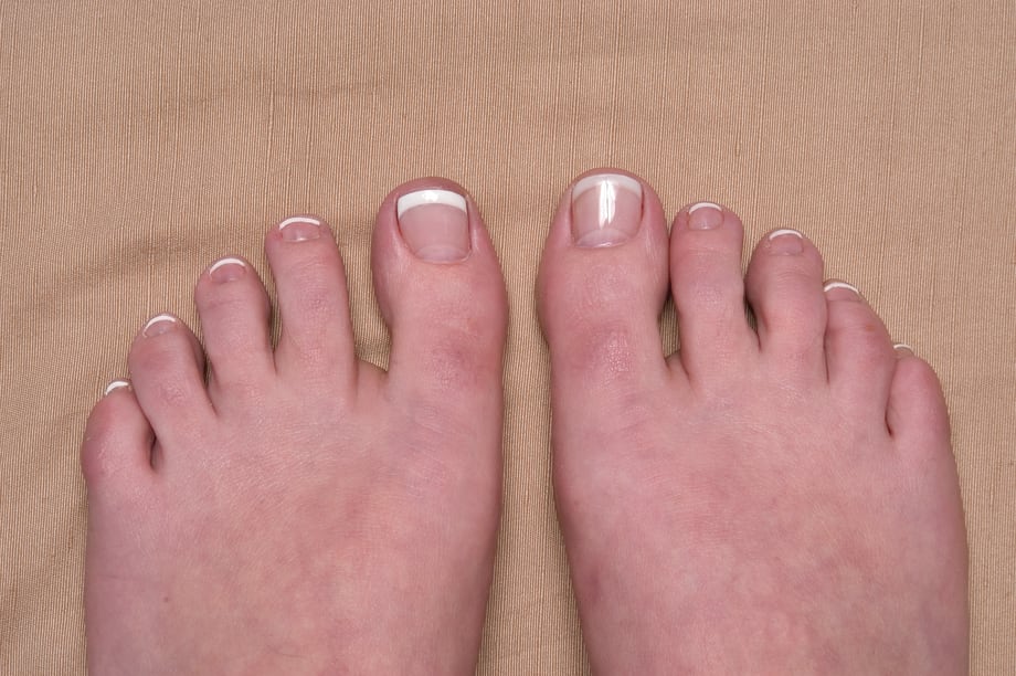 When Feet Go French