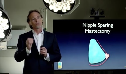 Nipple Sparing Reconstruction