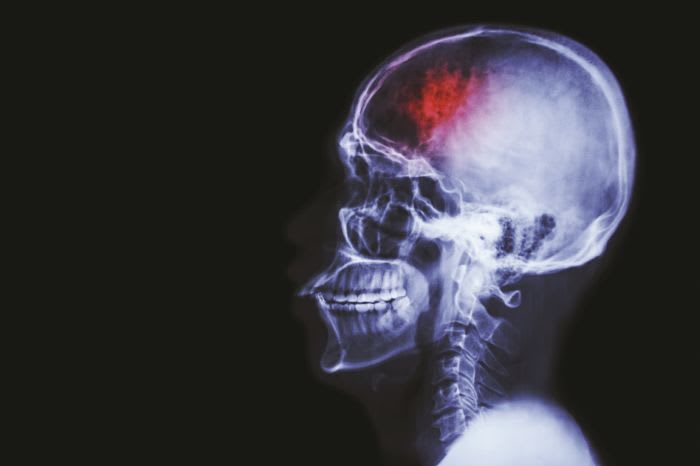 Did You Bump Your Head?