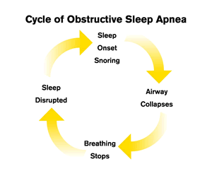 FRA, FMCSA withdraw obstructive sleep apnea rulemaking