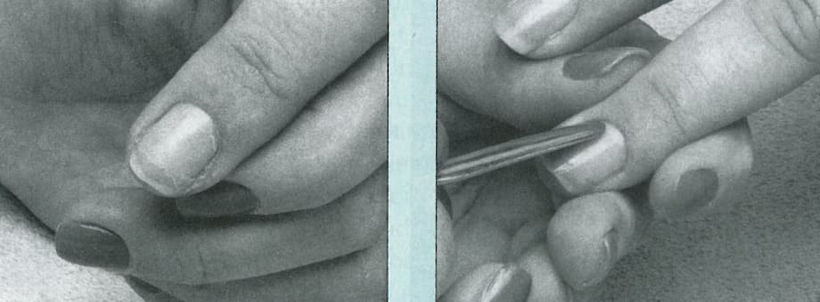 Strengthening Nails That Peel