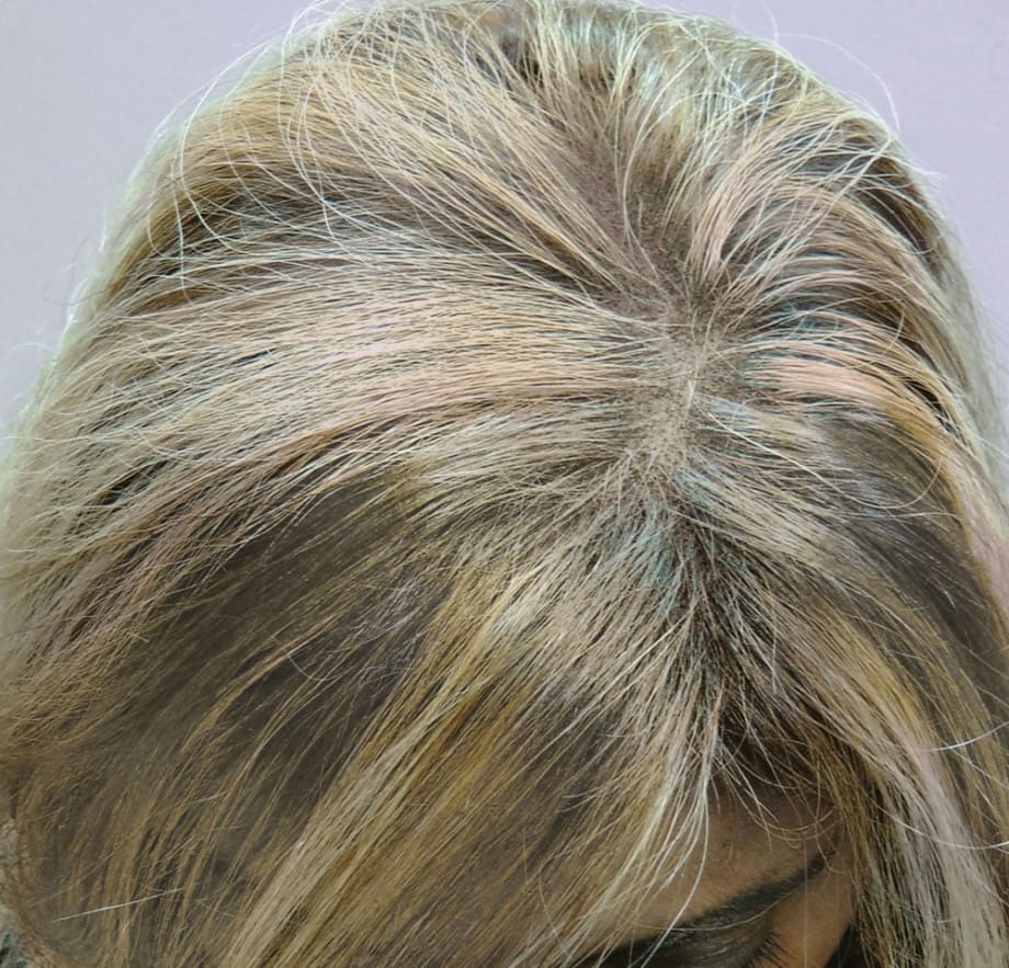 Before and Afters with SureThik Hair Thickening Fibers