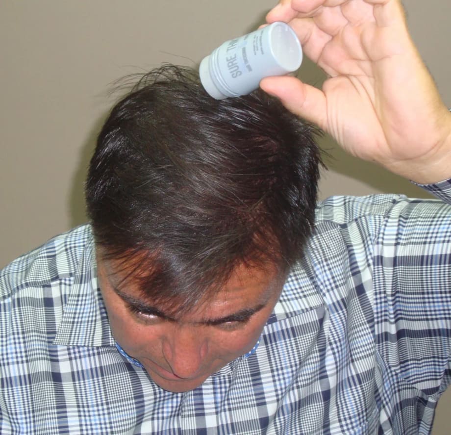 Before and Afters with SureThik Hair Thickening Fibers