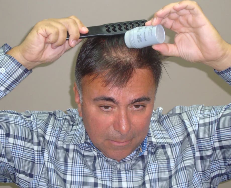 Before and Afters with SureThik Hair Thickening Fibers
