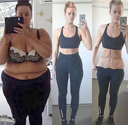 Salon Pro Faces Weight Loss Backlash