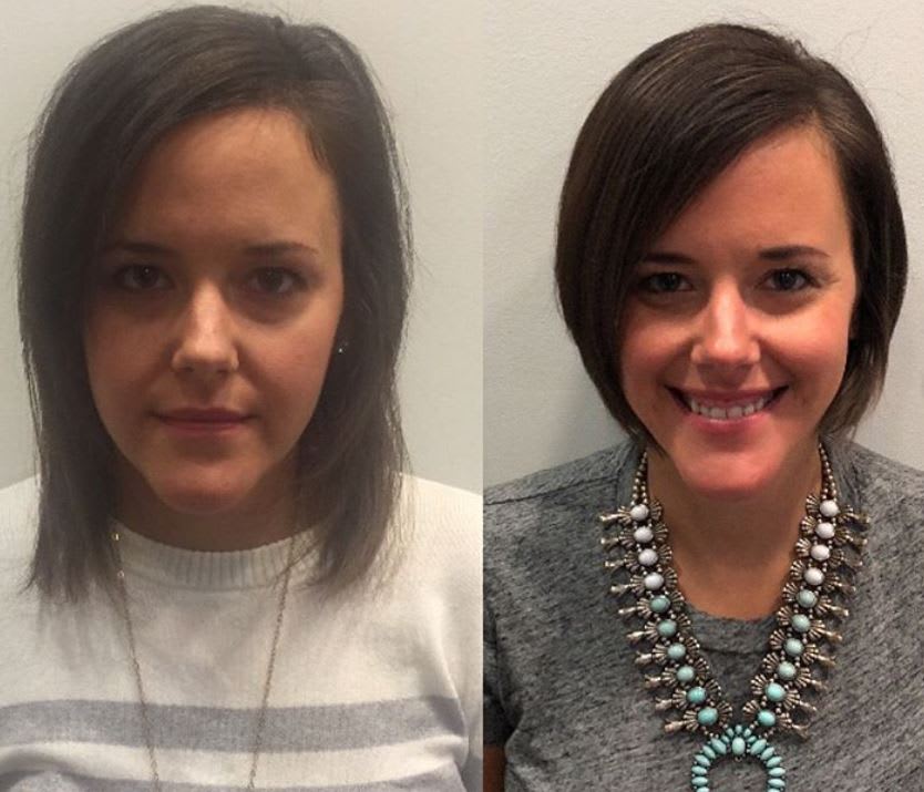 How to Be a Hair Hero to Someone Suffering with Hair Loss