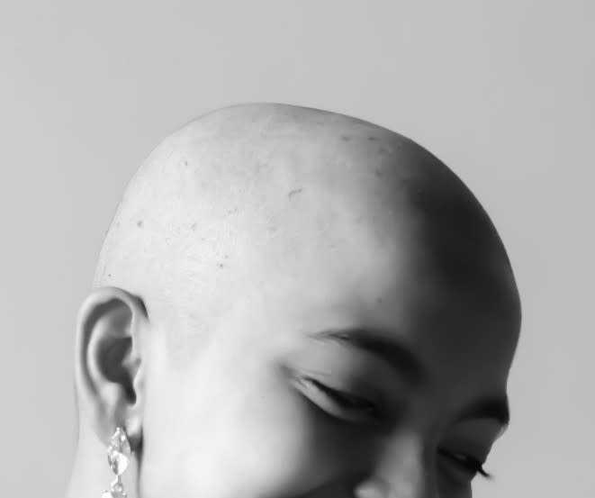 Pill May Help Alopecia Clients