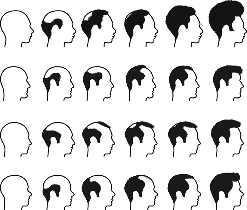 Why Every Stylist & Colorist Should Learn Trichology - (The Study of Hair Loss & Scalp Conditions)