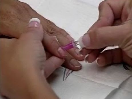 Backscratchers Accelawrap Prep Tutorial