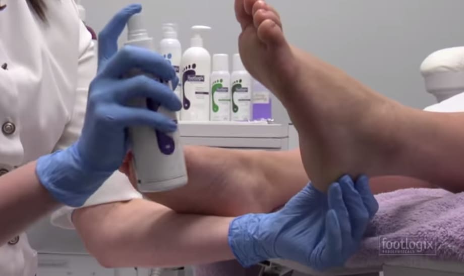 How to Remove Callus on Feet