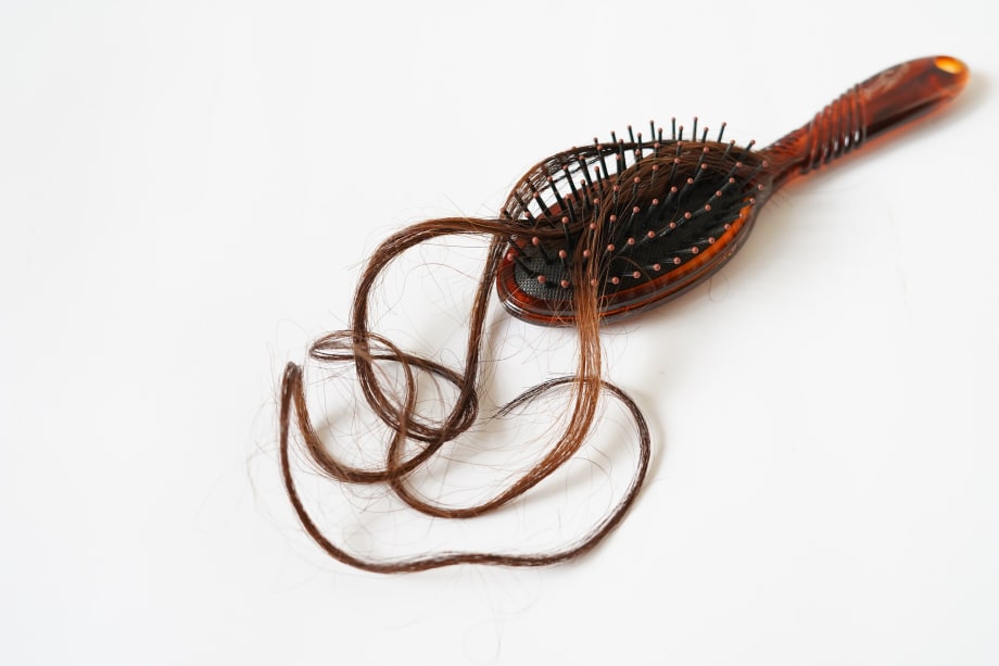 The Real Skinny on Thinning Hair