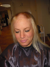 Clients with Trichotillomania: Hair Pulling and How To Help