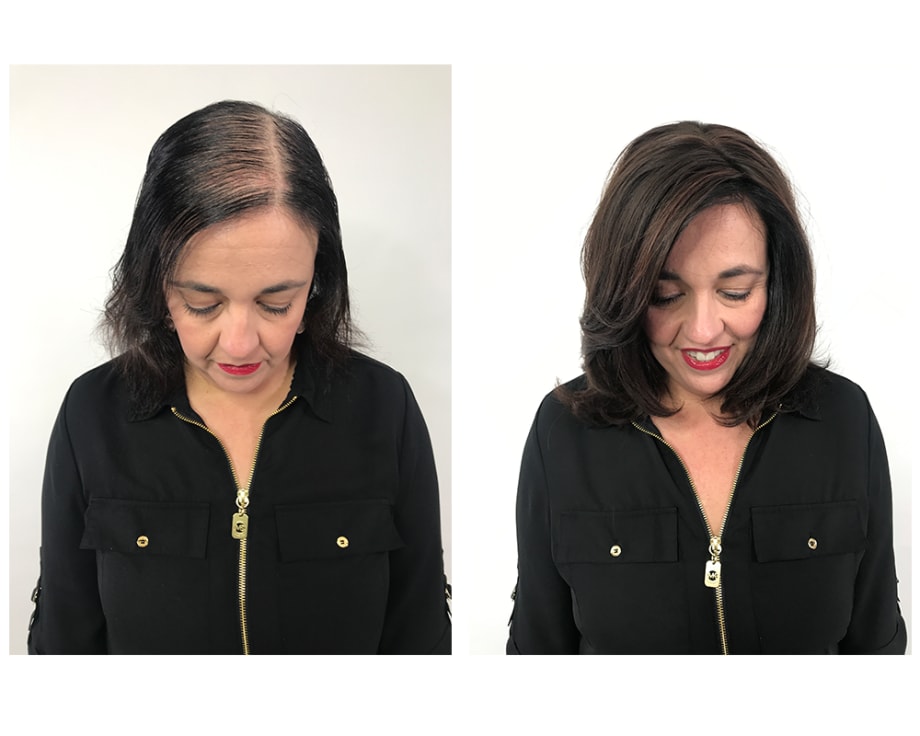 New Hope For Thinning Hair Clients