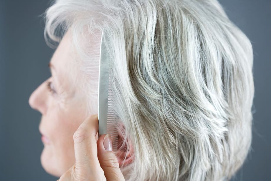 What's Changed in the Hair Loss Category?