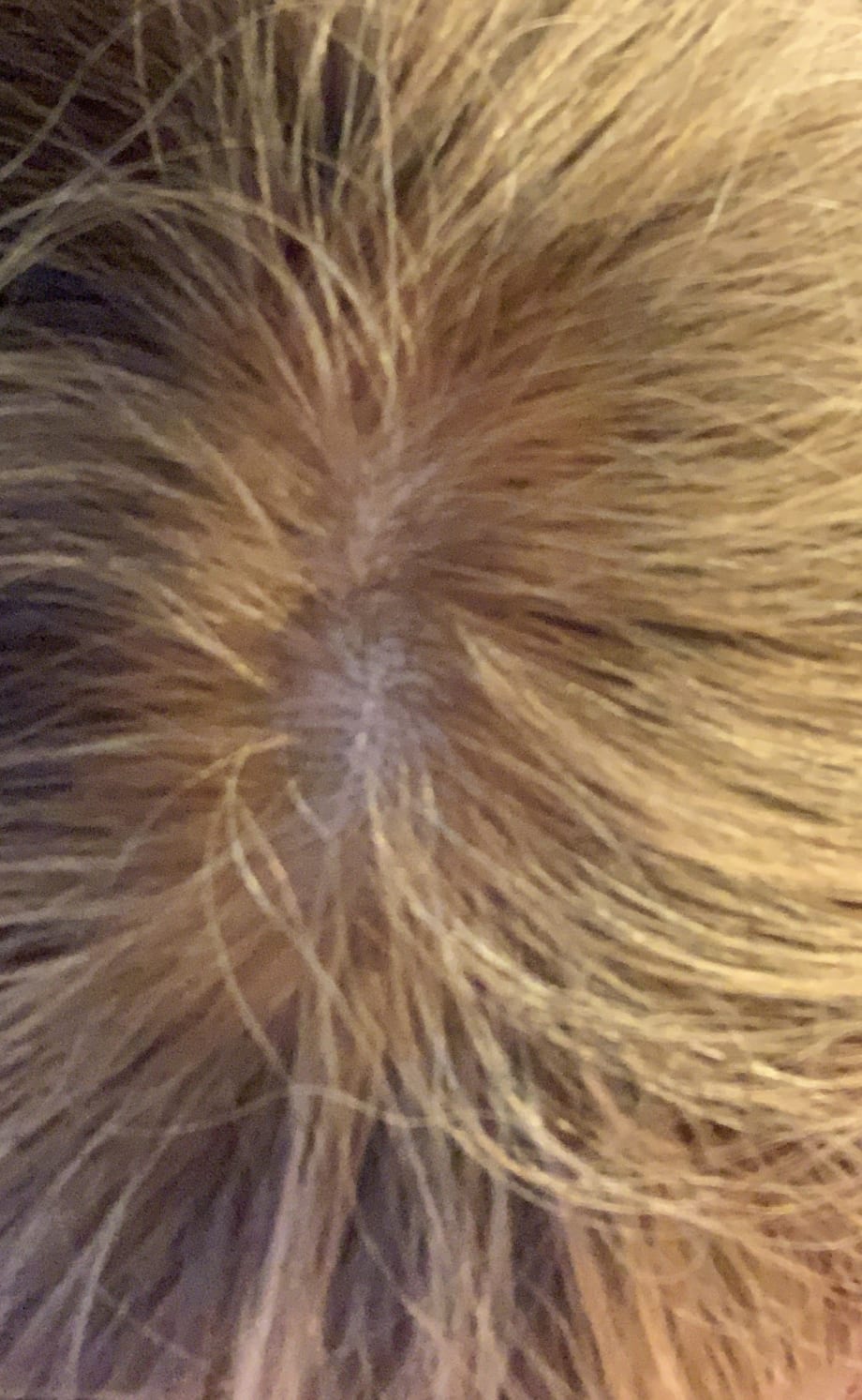 HOT ROOTS: 5 Tips To Deal With This Hot Topic