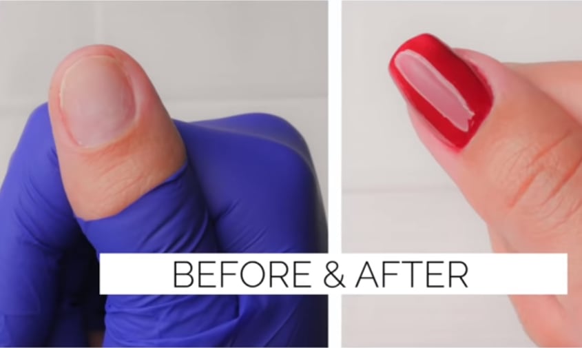 Two Ways to Fix Short Bitten Nails Using Gel