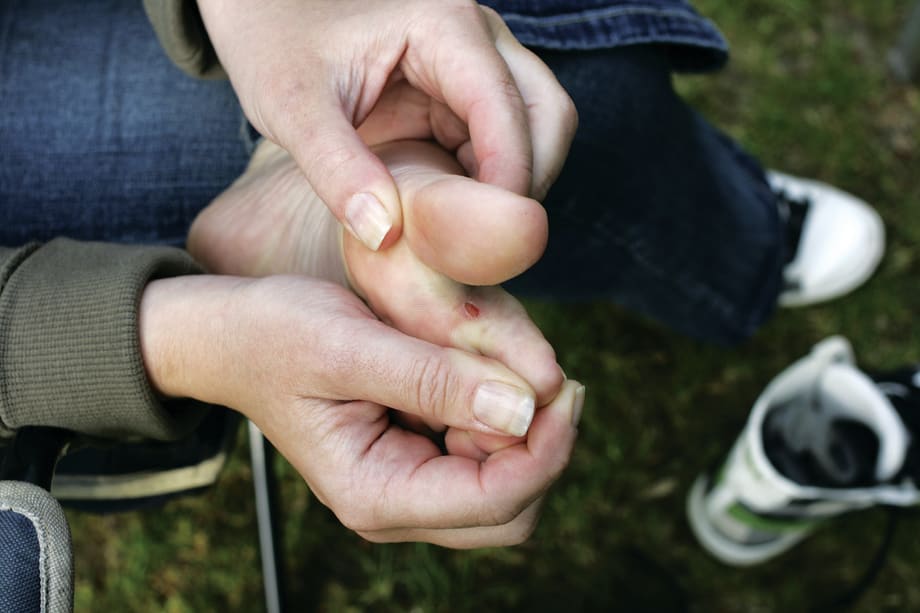 When Clients Have Blisters