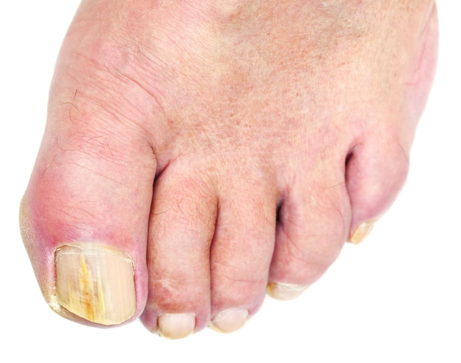 Something to Talk About:  Embarrassing Feet