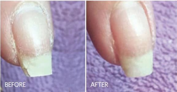 Don’t Be Daunted by Damaged Nails