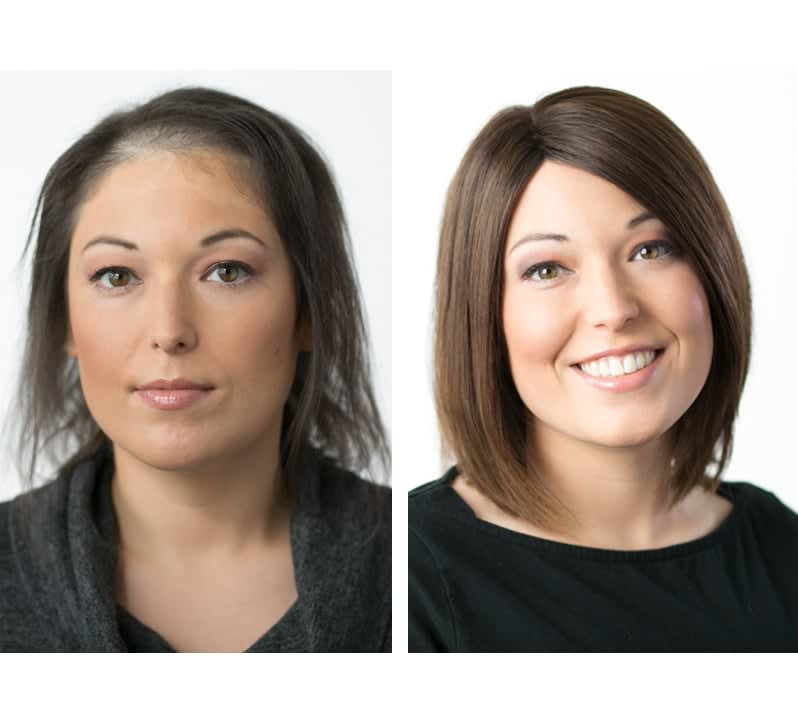 Business Builders: How to Find a Niche with Hair-Loss Clients