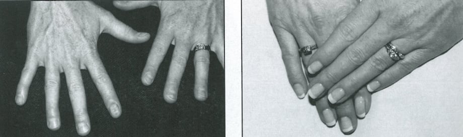Nail Makeovers Win Over Clients