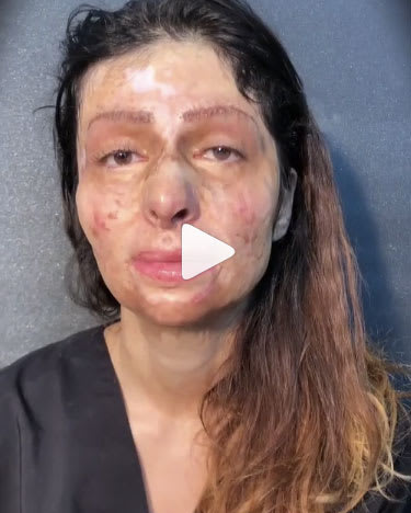 Grab Your Tissues: Makeup Artist Helps Client Realize Her Beauty Following Tragic Accident 